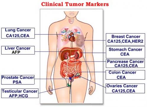 cancer colorectal markeri tumorali